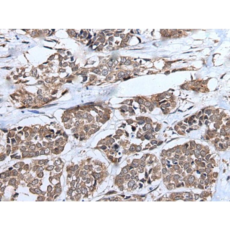 UBE4B Antibody from Signalway Antibody (43828) - Antibodies.com