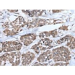 UBE4B Antibody from Signalway Antibody (43828) - Antibodies.com