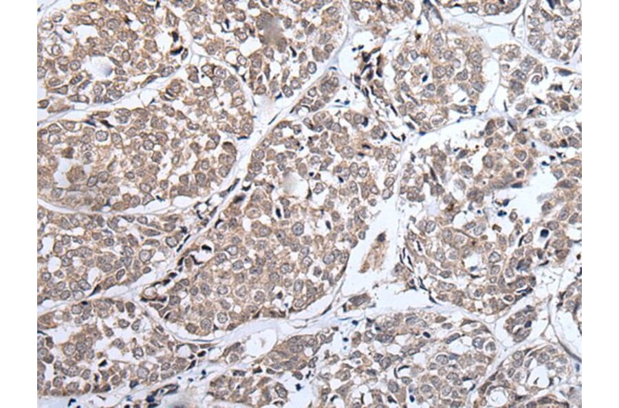 ERBB4 Antibody from Signalway Antibody (43833) - Antibodies.com