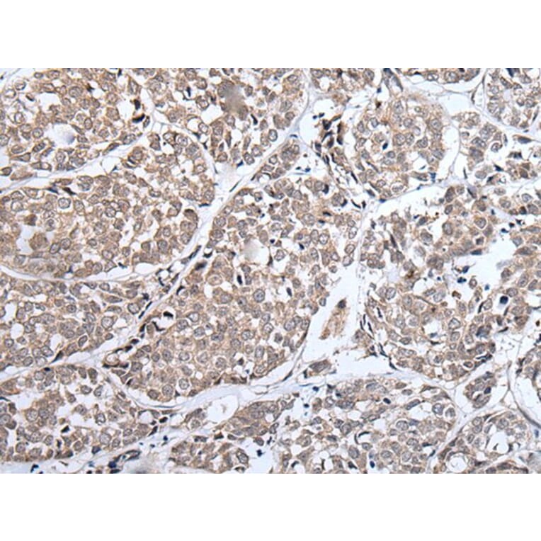 ERBB4 Antibody from Signalway Antibody (43833) - Antibodies.com