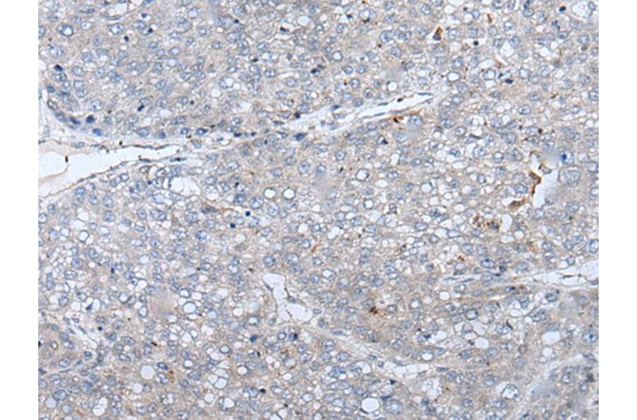 ERBB4 Antibody from Signalway Antibody (43833) - Antibodies.com