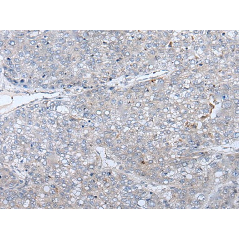 ERBB4 Antibody from Signalway Antibody (43833) - Antibodies.com