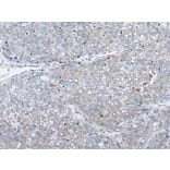 ERBB4 Antibody from Signalway Antibody (43833) - Antibodies.com