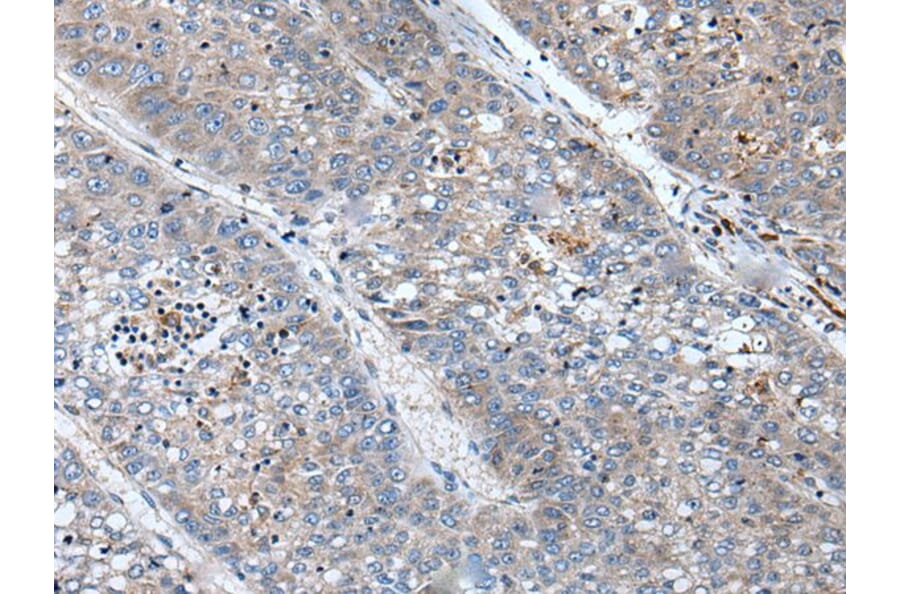 BICD1 Antibody from Signalway Antibody (43846) - Antibodies.com