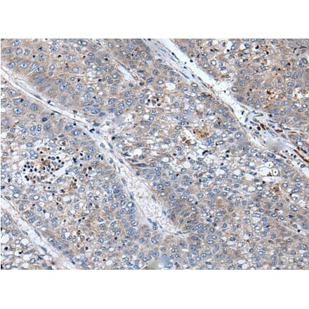 BICD1 Antibody from Signalway Antibody (43846) - Antibodies.com