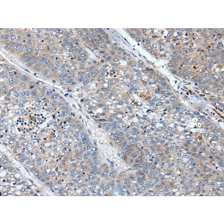 BICD1 Antibody from Signalway Antibody (43846) - Antibodies.com