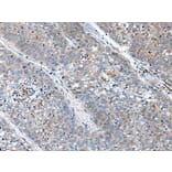 BICD1 Antibody from Signalway Antibody (43846) - Antibodies.com