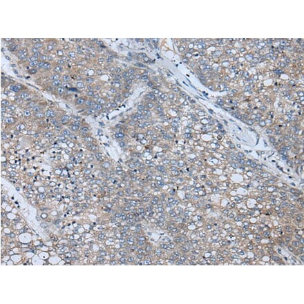 BICD2 Antibody from Signalway Antibody (43847) - Antibodies.com