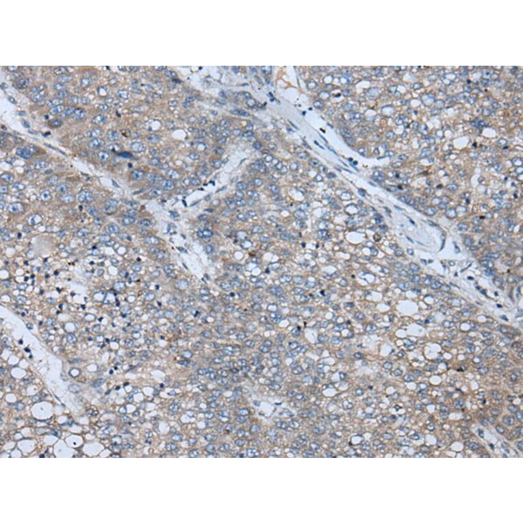 BICD2 Antibody from Signalway Antibody (43847) - Antibodies.com