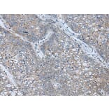 BICD2 Antibody from Signalway Antibody (43847) - Antibodies.com