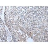 BICD2 Antibody from Signalway Antibody (43847) - Antibodies.com