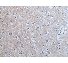 BRSK2 Antibody from Signalway Antibody (43854) - Antibodies.com
