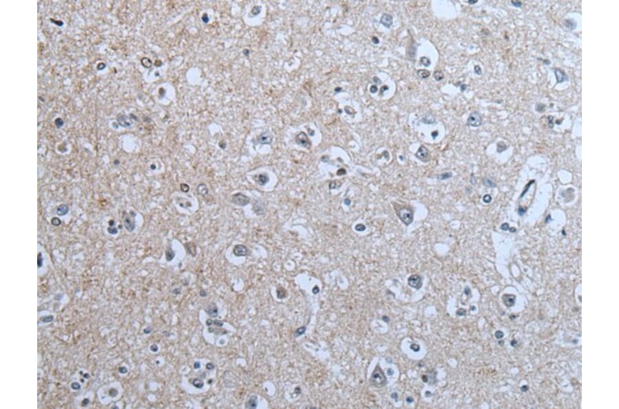 BRSK2 Antibody from Signalway Antibody (43854) - Antibodies.com