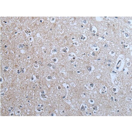 BRSK2 Antibody from Signalway Antibody (43854) - Antibodies.com