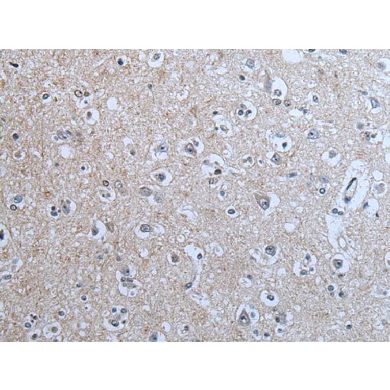 BRSK2 Antibody from Signalway Antibody (43854) - Antibodies.com