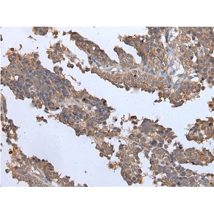ENPP2 Antibody from Signalway Antibody (43857) - Antibodies.com