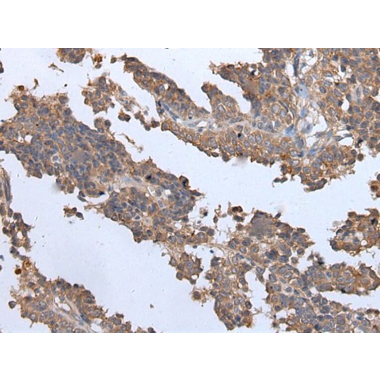 ENPP2 Antibody from Signalway Antibody (43857) - Antibodies.com