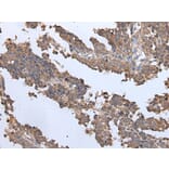 ENPP2 Antibody from Signalway Antibody (43857) - Antibodies.com