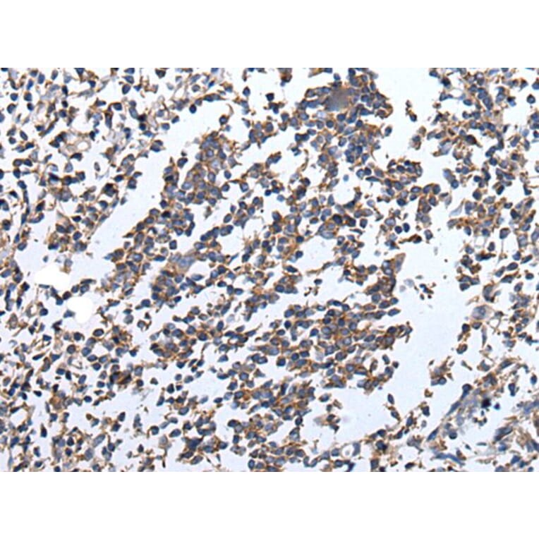ENPP2 Antibody from Signalway Antibody (43857) - Antibodies.com