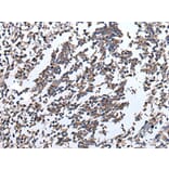 ENPP2 Antibody from Signalway Antibody (43857) - Antibodies.com