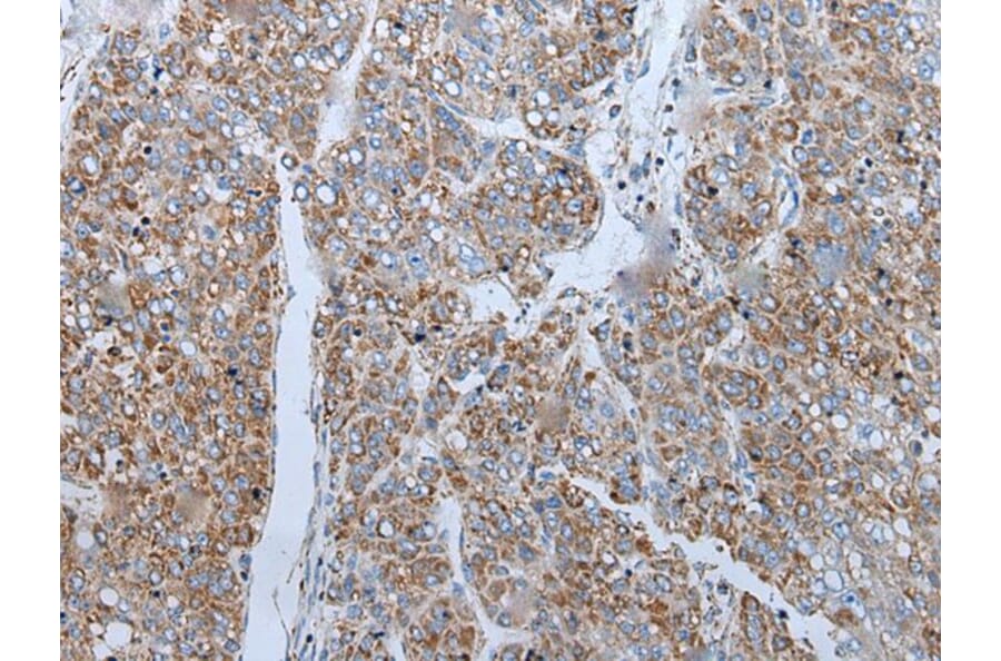 ENKUR Antibody from Signalway Antibody (43859) - Antibodies.com