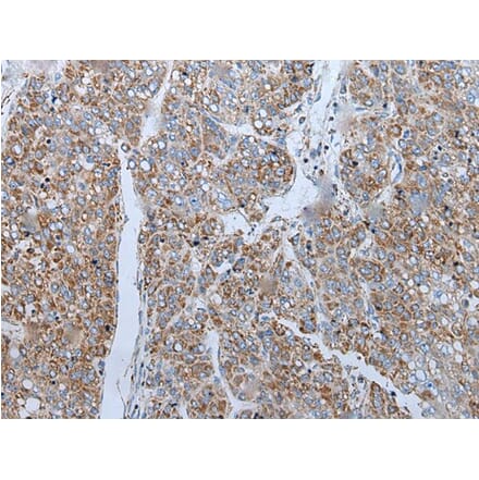 ENKUR Antibody from Signalway Antibody (43859) - Antibodies.com