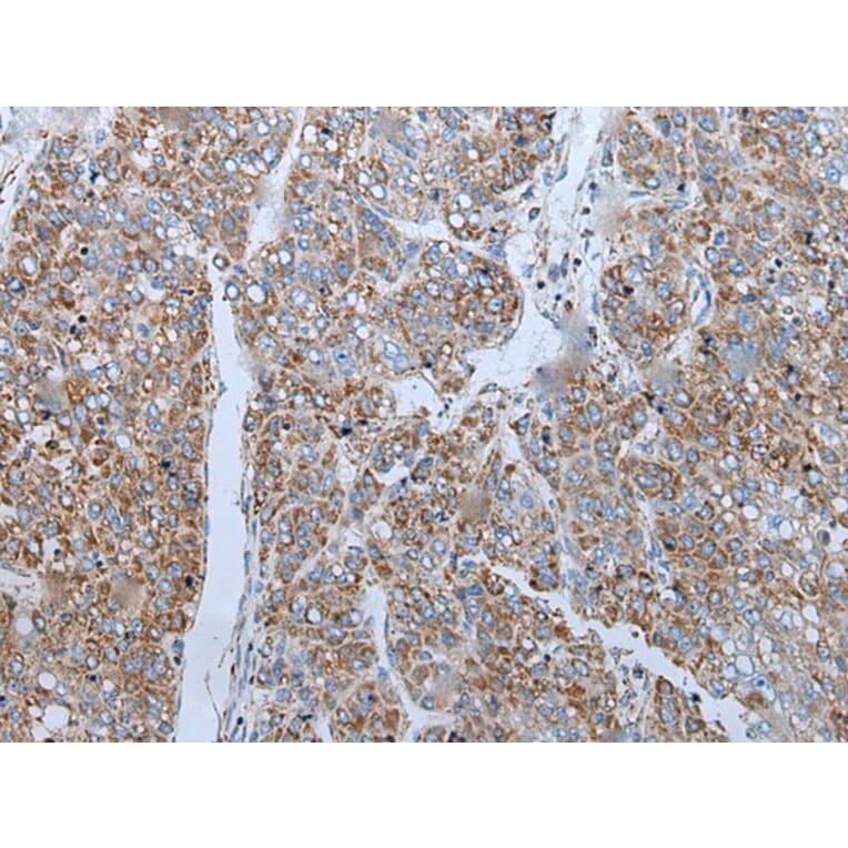 ENKUR Antibody from Signalway Antibody (43859) - Antibodies.com