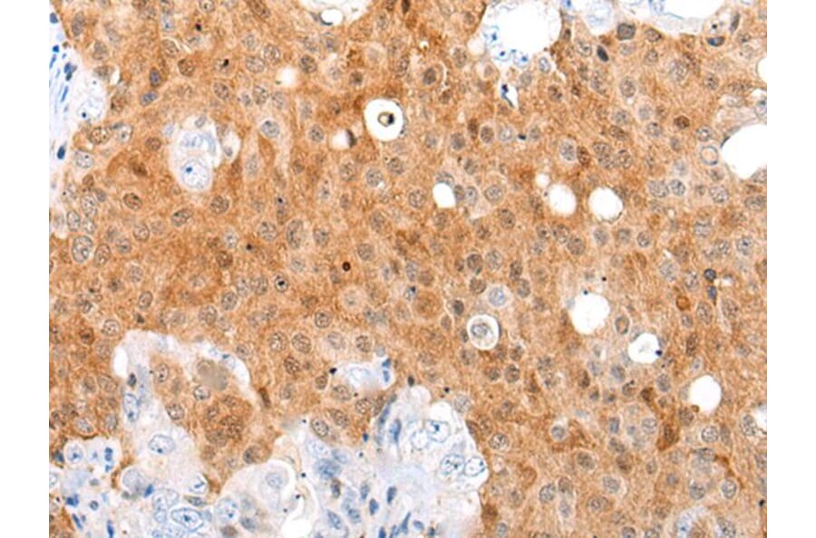 AKIP1 Antibody from Signalway Antibody (43863) - Antibodies.com