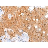AKIP1 Antibody from Signalway Antibody (43863) - Antibodies.com