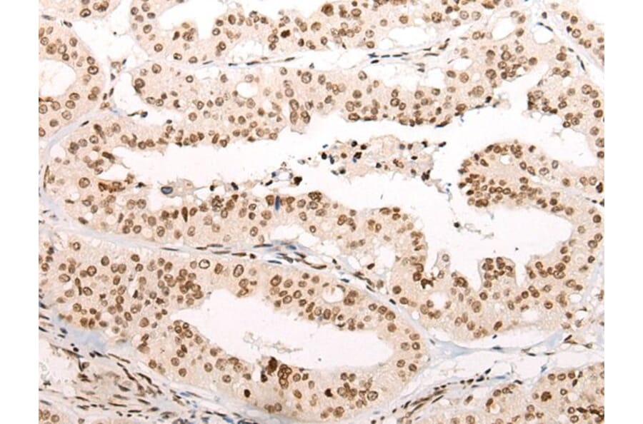 VPS51 Antibody from Signalway Antibody (43864) - Antibodies.com