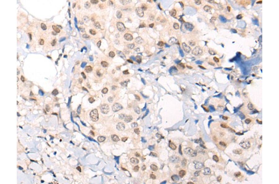 VPS51 Antibody from Signalway Antibody (43864) - Antibodies.com