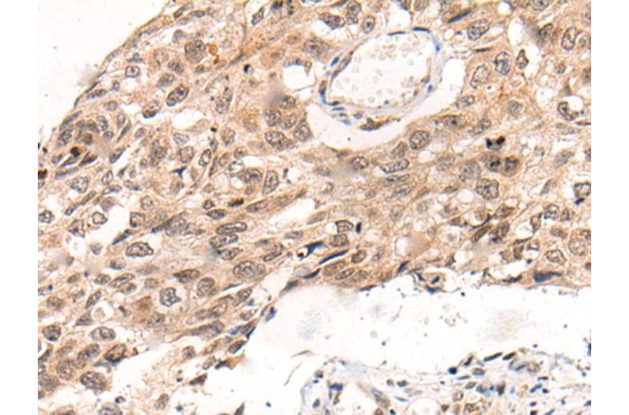 KNOP1 Antibody from Signalway Antibody (43872) - Antibodies.com