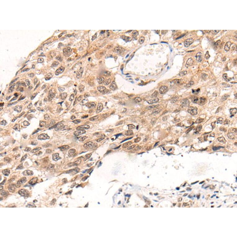 KNOP1 Antibody from Signalway Antibody (43872) - Antibodies.com