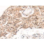 KNOP1 Antibody from Signalway Antibody (43872) - Antibodies.com