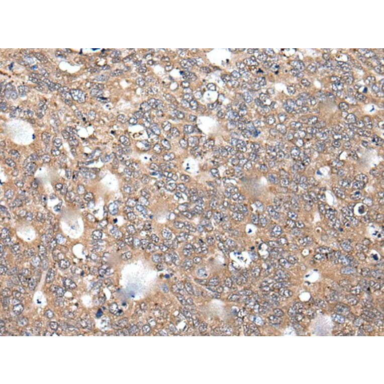 ITGA5 Antibody from Signalway Antibody (43879) - Antibodies.com