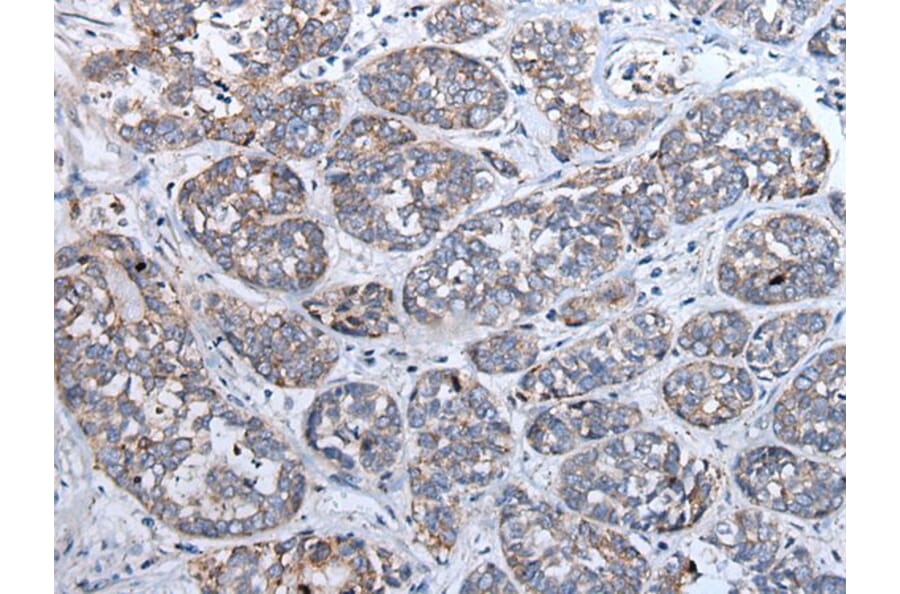 SFRP5 Antibody from Signalway Antibody (43902) - Antibodies.com