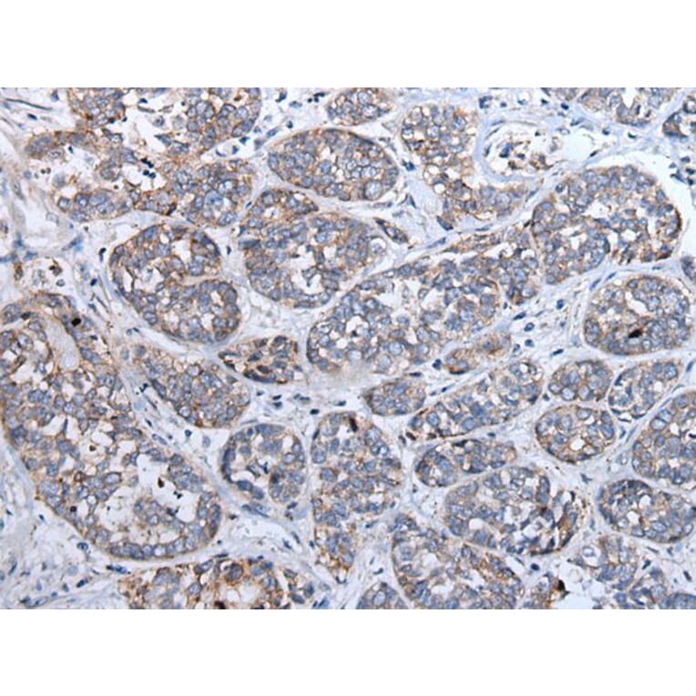 SFRP5 Antibody from Signalway Antibody (43902) - Antibodies.com