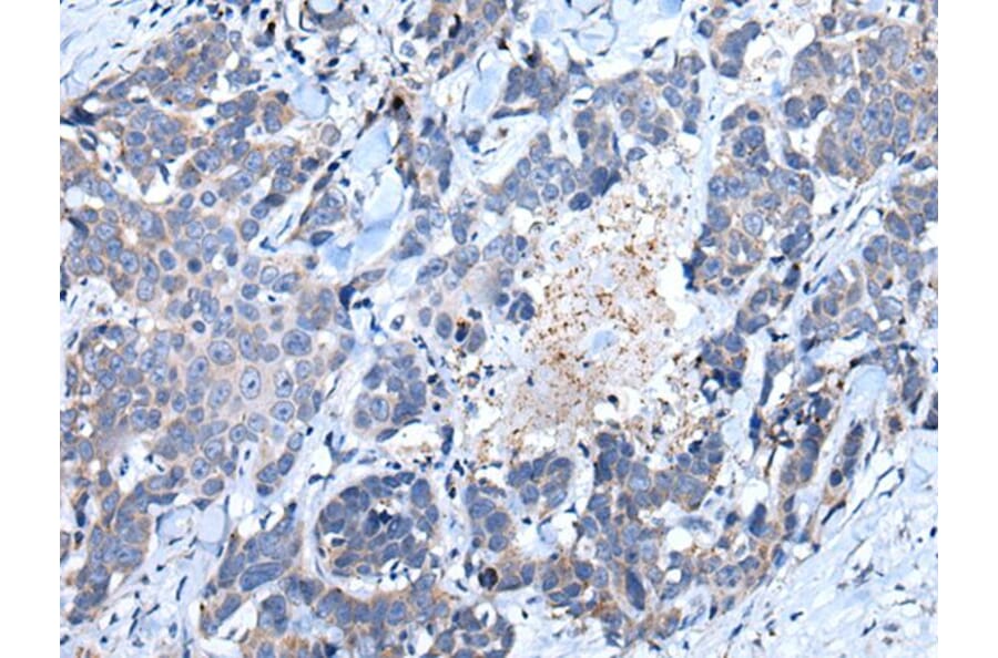 SFRP5 Antibody from Signalway Antibody (43902) - Antibodies.com