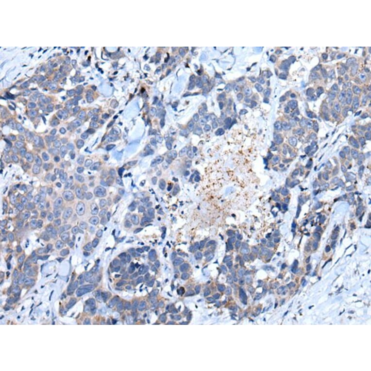 SFRP5 Antibody from Signalway Antibody (43902) - Antibodies.com
