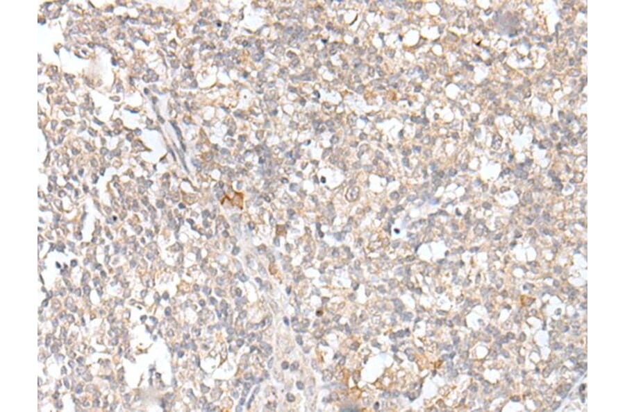 KLRC3 Antibody from Signalway Antibody (43916) - Antibodies.com