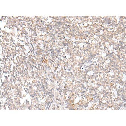 KLRC3 Antibody from Signalway Antibody (43916) - Antibodies.com