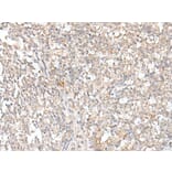 KLRC3 Antibody from Signalway Antibody (43916) - Antibodies.com