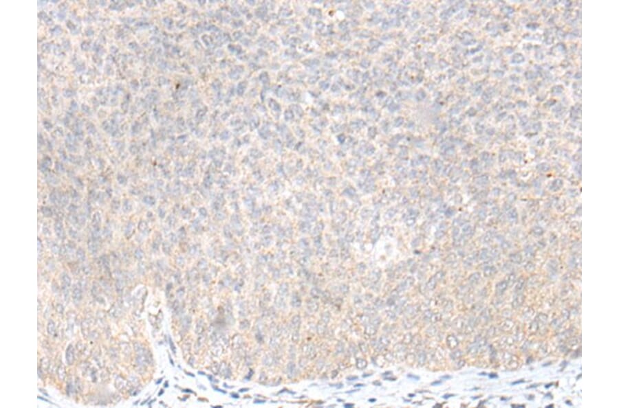 KLRC3 Antibody from Signalway Antibody (43916) - Antibodies.com