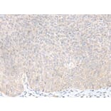 KLRC3 Antibody from Signalway Antibody (43916) - Antibodies.com