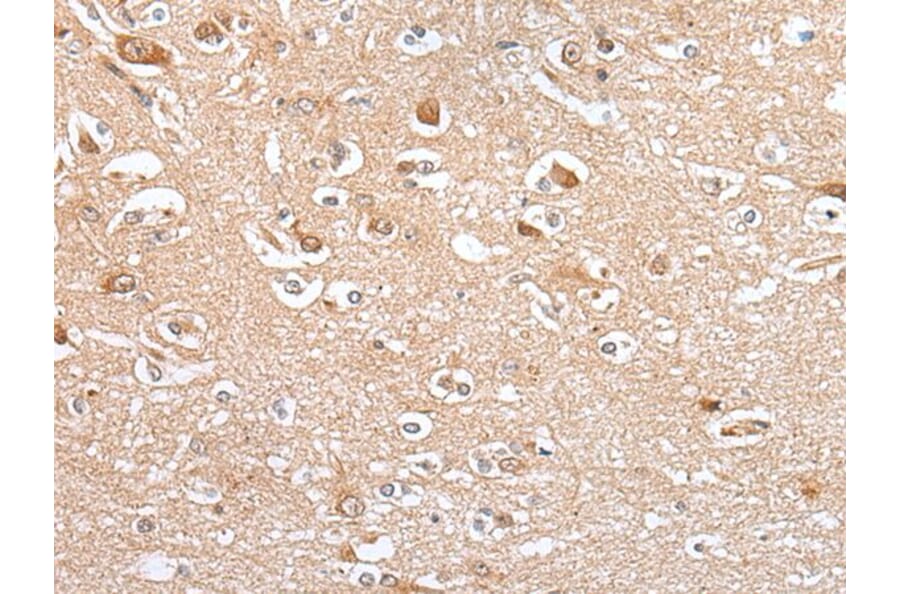 CES4A Antibody from Signalway Antibody (43923) - Antibodies.com