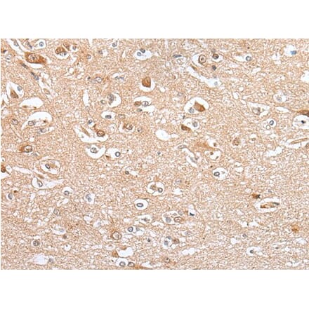 CES4A Antibody from Signalway Antibody (43923) - Antibodies.com