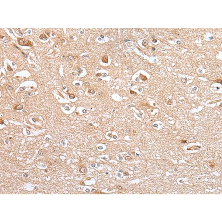 CES4A Antibody from Signalway Antibody (43923) - Antibodies.com