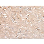 CES4A Antibody from Signalway Antibody (43923) - Antibodies.com