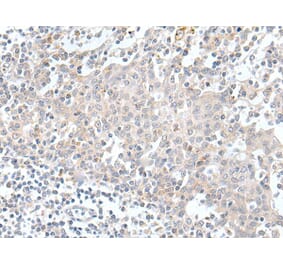 KCNH1 Antibody from Signalway Antibody (43927) - Antibodies.com