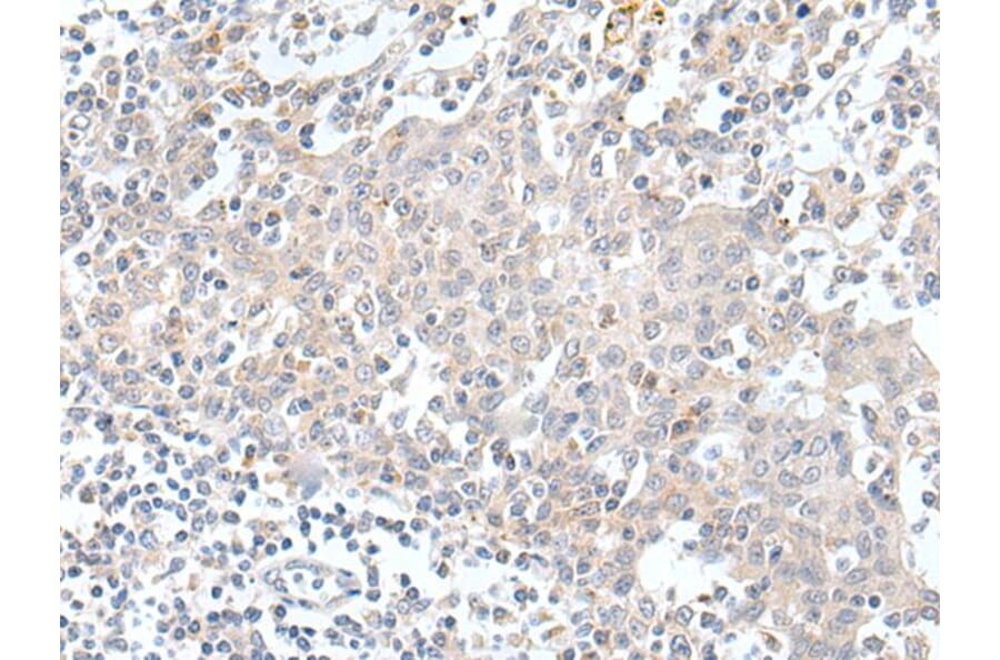 KCNH1 Antibody from Signalway Antibody (43927) - Antibodies.com